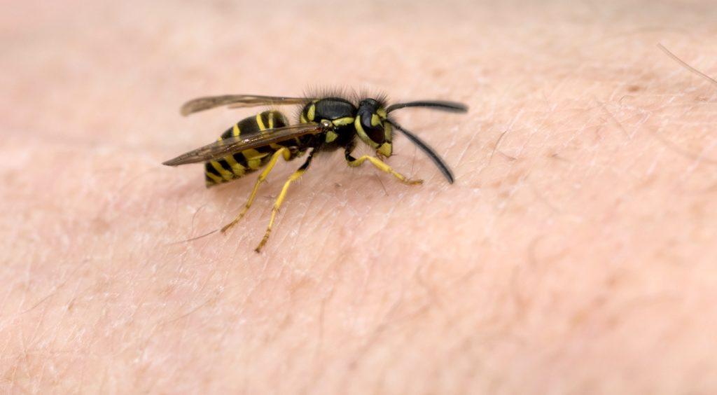 When should I be concerned about wasp sting?